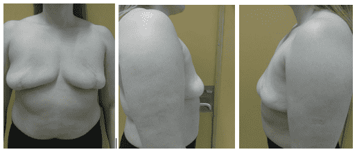 Three angles of a woman's upper body