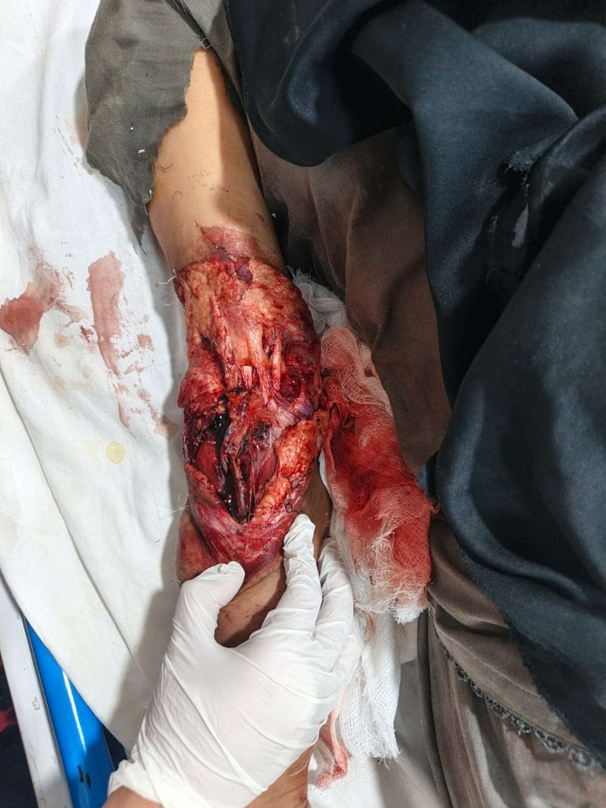 1771947180 whatsapp image 2026 02 24 at 8 32 14 pm