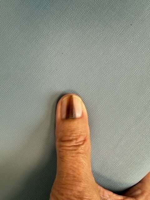 Thumb pressing against textured surface