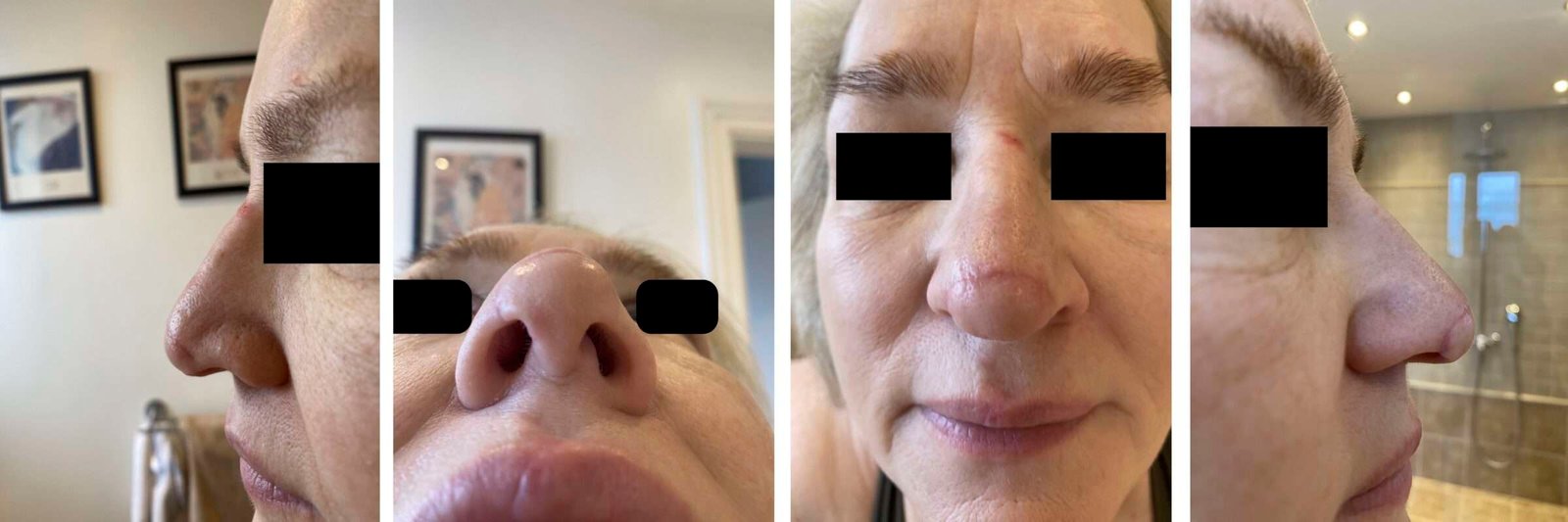 Close-up collage of a woman's nose