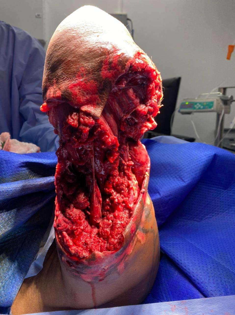 Close-up of a medical procedure