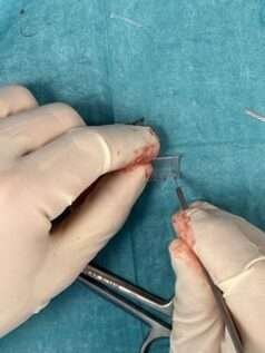 Surgical hands manipulating medical tool
