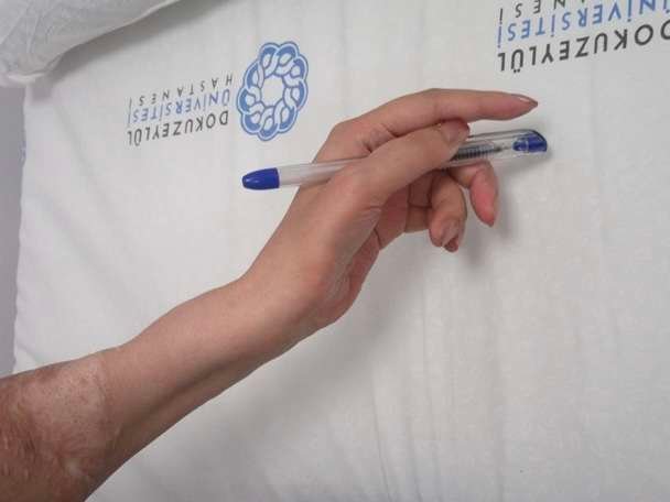 postop after debulking 4