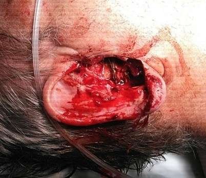 Injured ear with visible wound and blood.