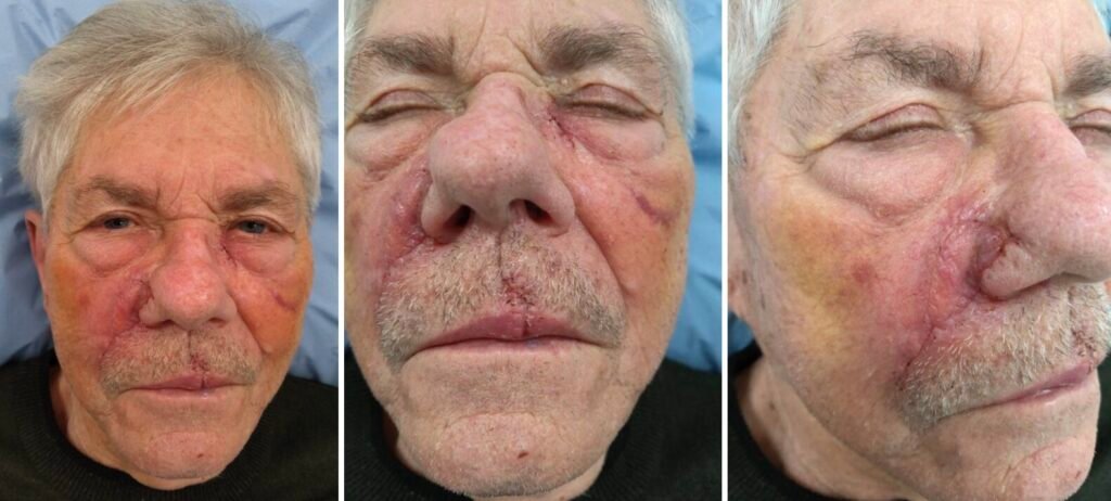 Close-up of an elderly man's face