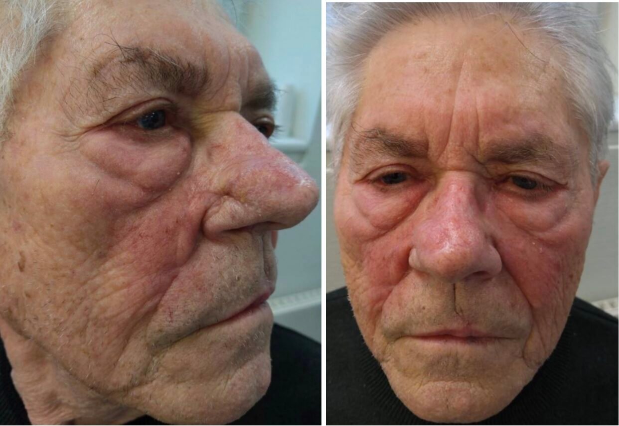 Elderly man with facial skin texture