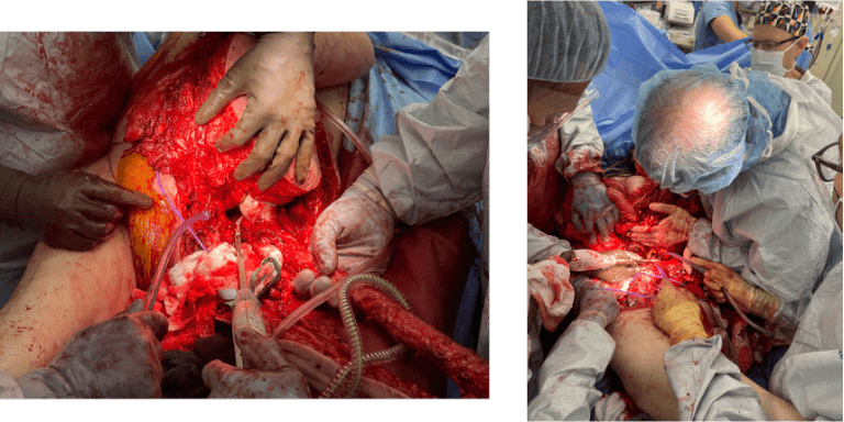 Doctors performing complex surgical operation