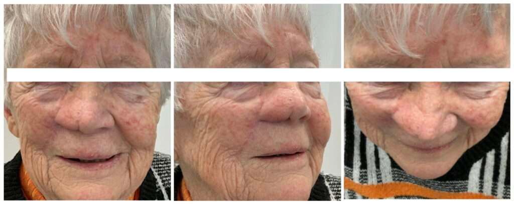 Close-up of elderly woman's face