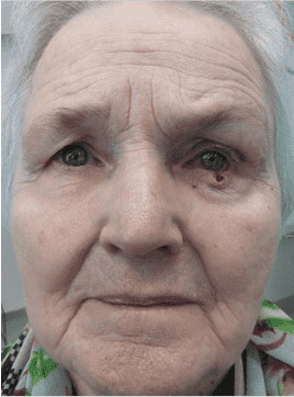 Elderly woman with a concerned expression.