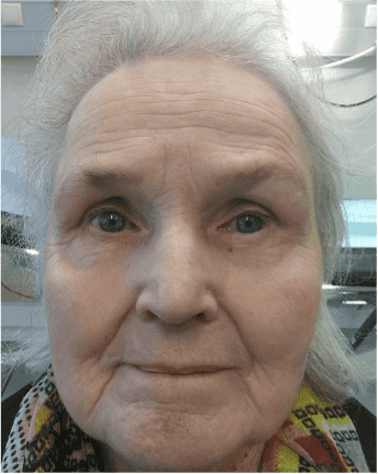 Elderly woman with neutral expression.
