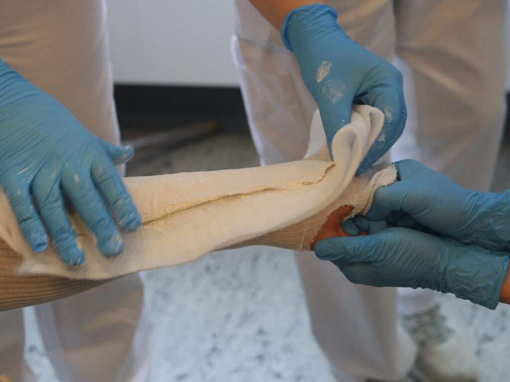 Medical professionals applying a splint